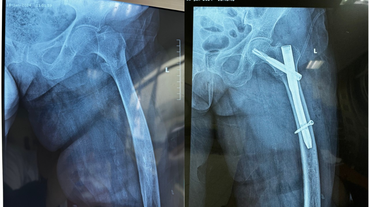 Hình ảnh trước và sau phẫu thuật.